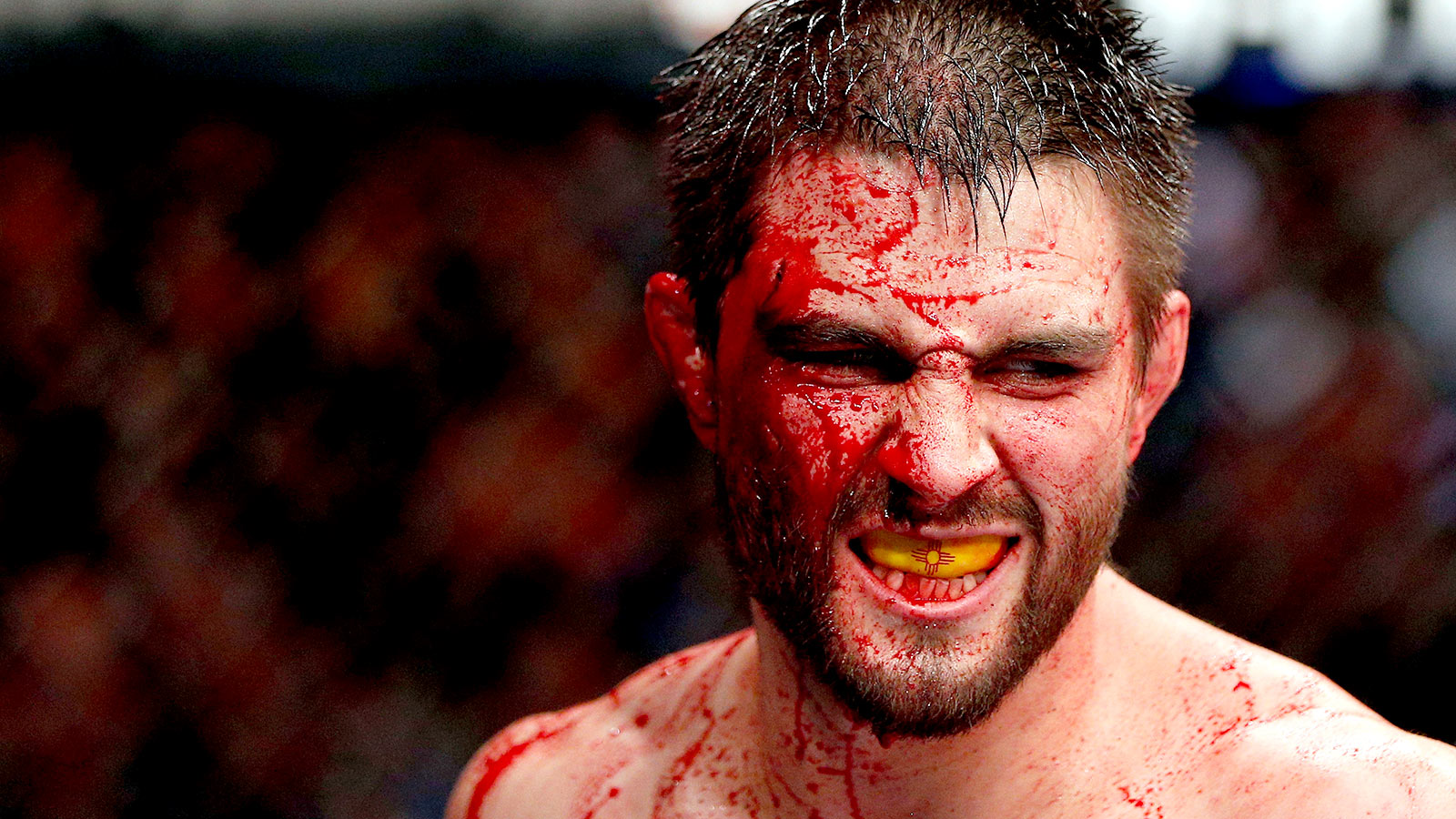 Where is Carlos Condit Now?